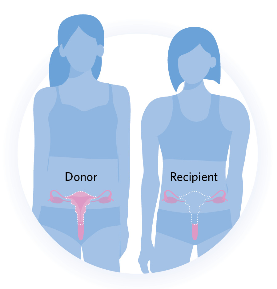 A Community Voice: Advocating For Uterus Transplants In Transgender Healthcare A Community Voice: Advocating For Uterus Transplants In Transgender Healthcare