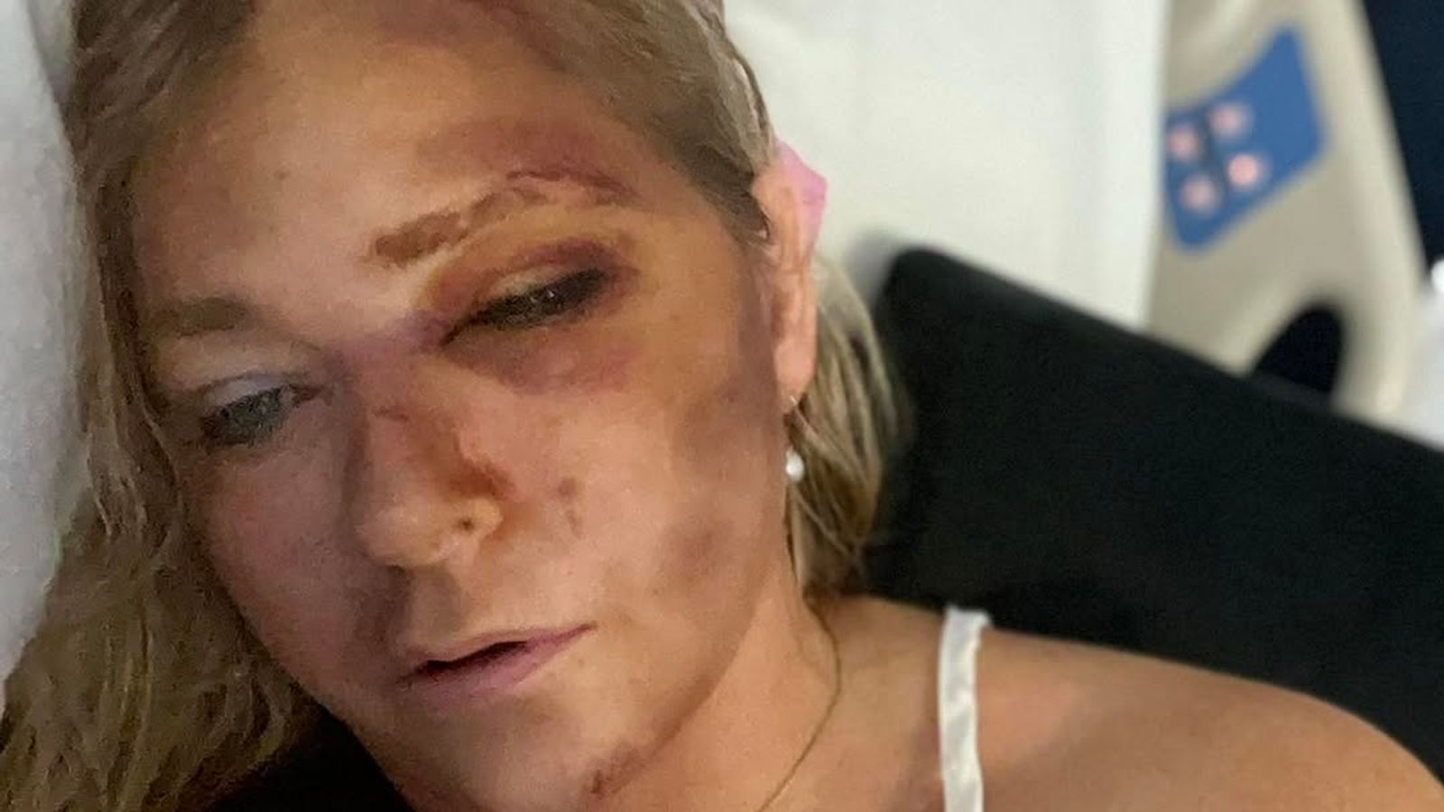 Bus Crash Leaves Prince Andrew Accuser With Days To Live: Her Statement Bus Crash Leaves Prince Andrew Accuser With Days To Live: Her Statement