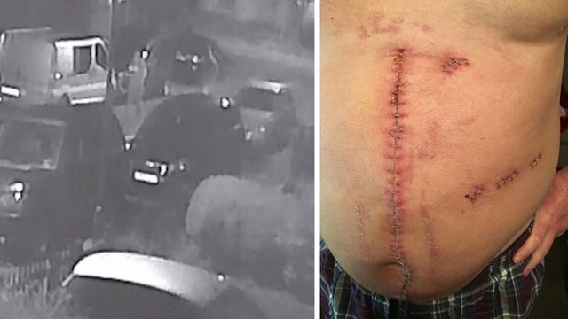 Death After Racist Stabbing: Woman's Unprovoked Attack Death After Racist Stabbing: Woman's Unprovoked Attack