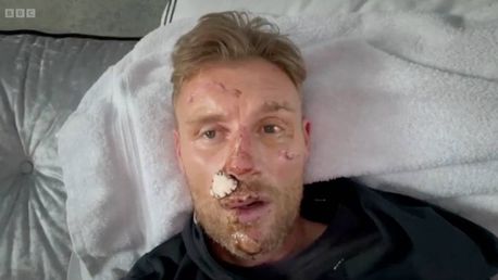 Freddie Flintoff's Disney+ Documentary: Horror Crash Details Revealed Freddie Flintoff's Disney+ Documentary: Horror Crash Details Revealed