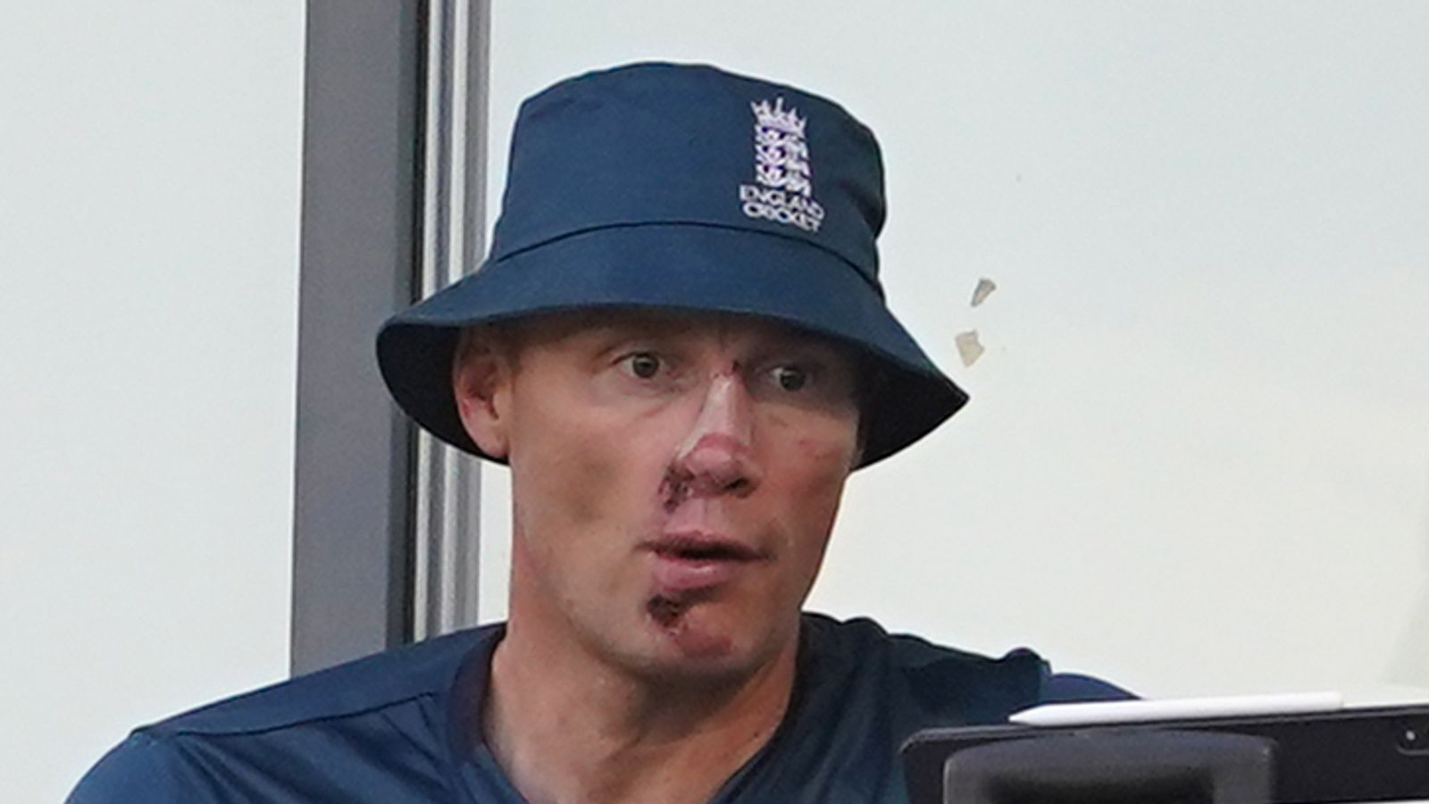 Freddie Flintoff's Healed Face: A Look After The Top Gear Crash Freddie Flintoff's Healed Face: A Look After The Top Gear Crash