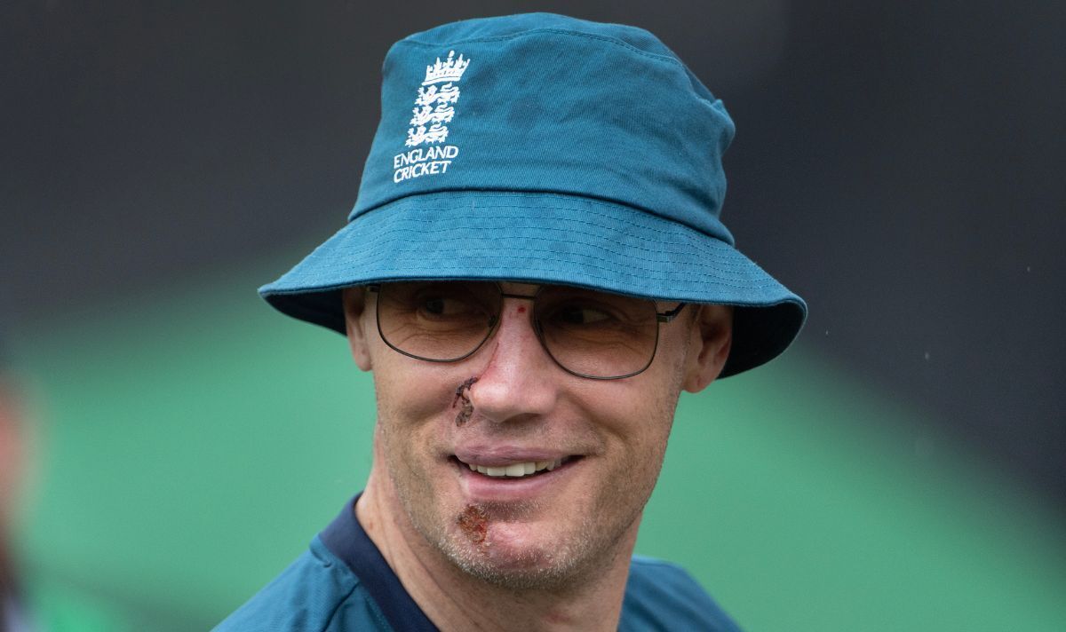 Freddie Flintoff's Recovery: From Crash To New Role – Addressing PTSD And Facial Injuries Freddie Flintoff's Recovery: From Crash To New Role – Addressing PTSD And Facial Injuries