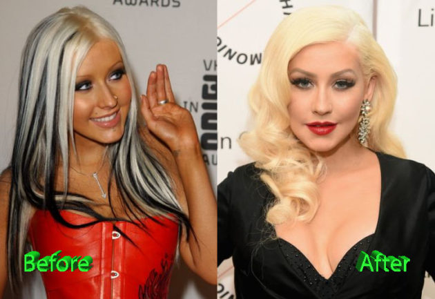 Has Christina Aguilera Had Plastic Surgery? Fan Speculation Runs Wild Has Christina Aguilera Had Plastic Surgery? Fan Speculation Runs Wild