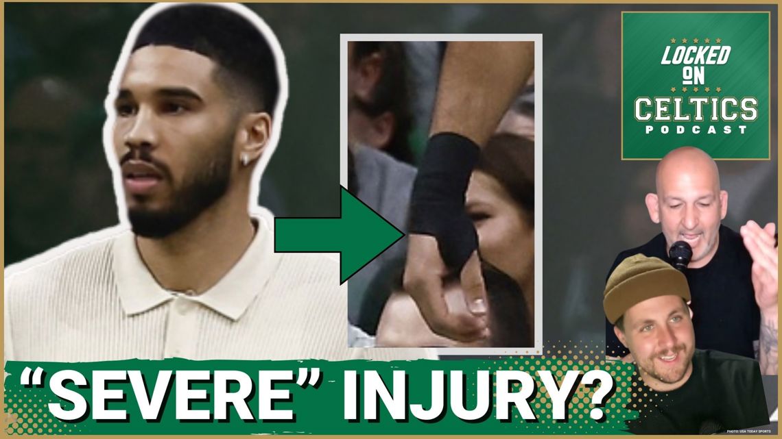 Jayson Tatum's Bone Bruise: Game 2 Status Update Jayson Tatum's Bone Bruise: Game 2 Status Update
