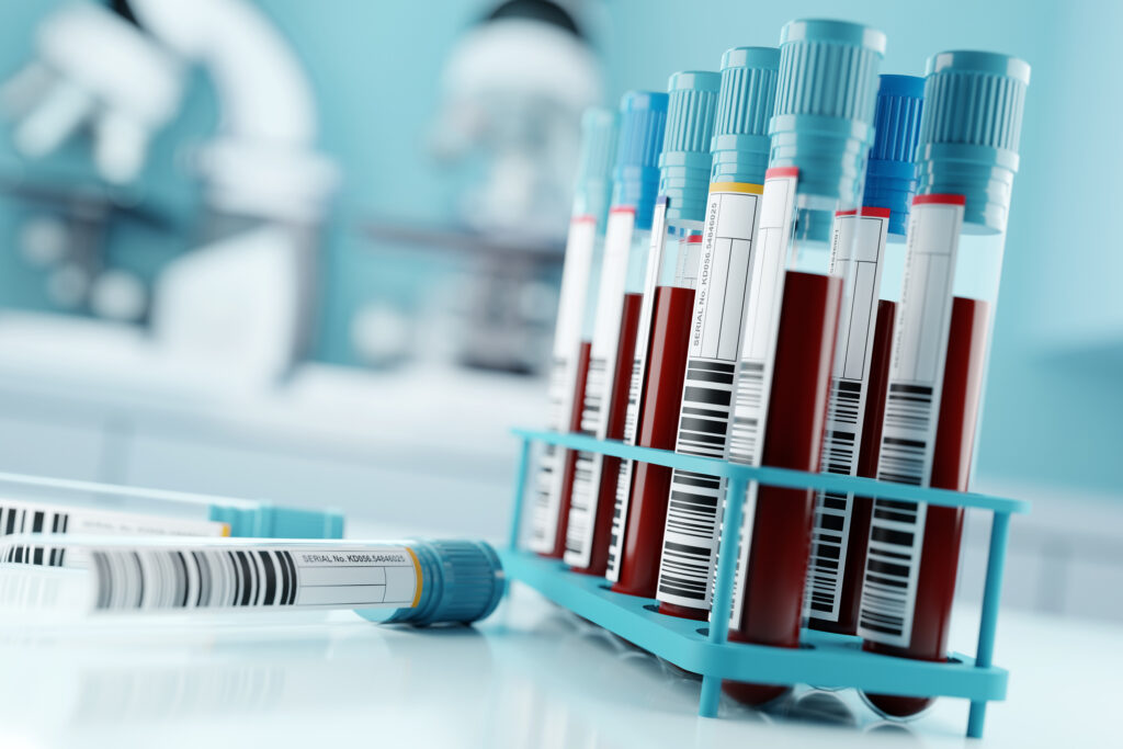 Lab Owner's Guilty Plea: Faking COVID-19 Test Results During Pandemic Lab Owner's Guilty Plea: Faking COVID-19 Test Results During Pandemic