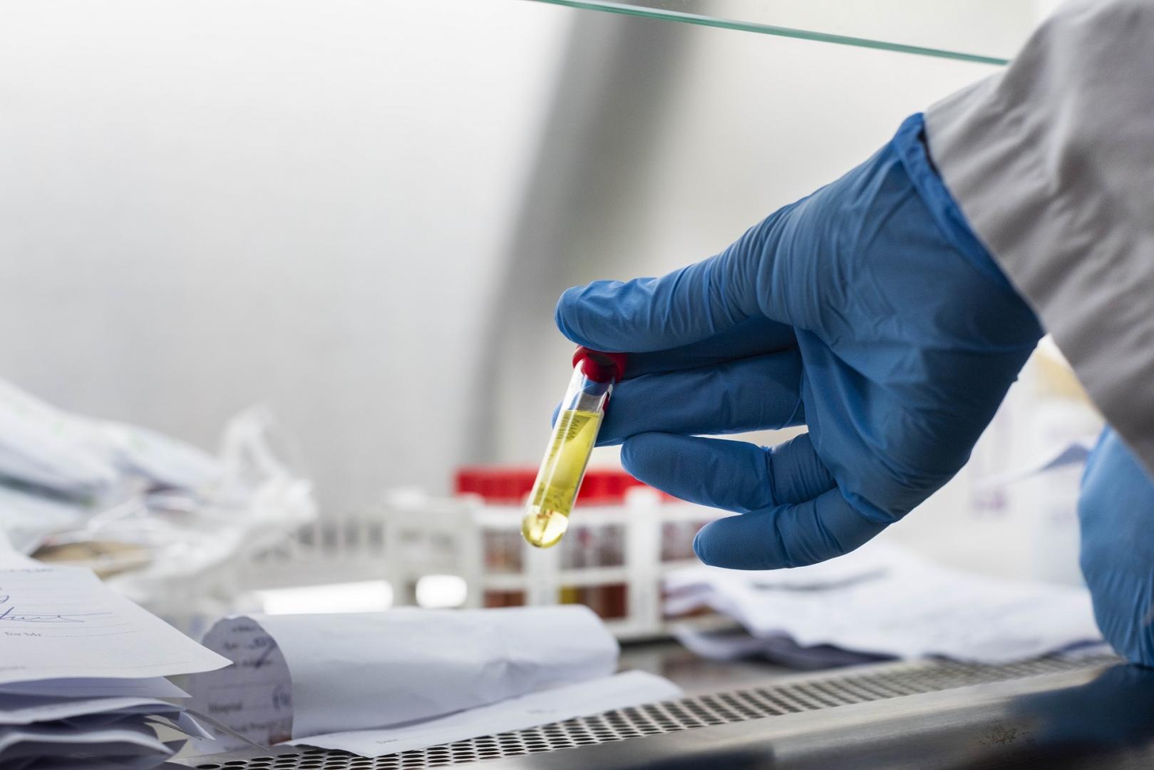 New COVID-19 Variants BA.1 And LF.7 Detected In India: Assessing The Risk New COVID-19 Variants BA.1 And LF.7 Detected In India: Assessing The Risk