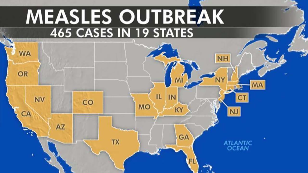 US Vaccine Safety Monitoring Intensifies As Measles Cases Rise US Vaccine Safety Monitoring Intensifies As Measles Cases Rise