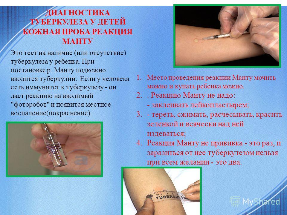 Заражение Корью В Монголии: Призыв К Немедленным Действиям Заражение Корью В Монголии: Призыв К Немедленным Действиям